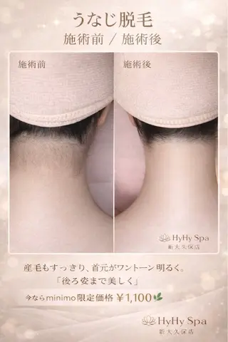 HyHy Spa Massage所属・HyHy Spa 新大久保店のエステ・リラクイメージ