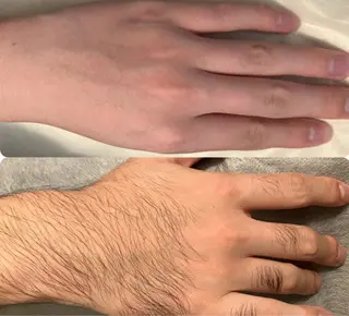 メンズ Butterfly 平塚店　佐藤のエステ・リラクイメージ