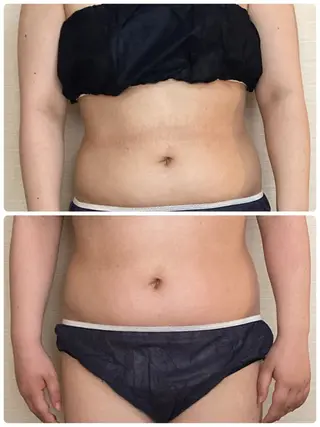 宮本 しおりのエステ・リラクイメージ