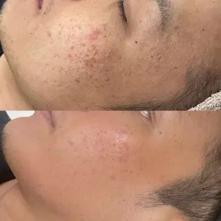 エステサロンTug高知駅前店所属・Tug 高知駅前店/ NANAMIのその他イメージ