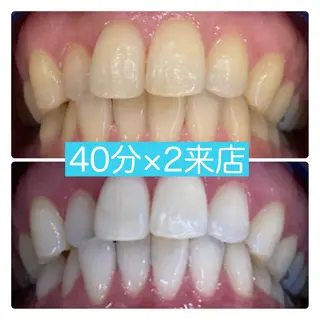 PLATINUM Beauty 横浜店所属・ホワイトニングルーム 横浜店のその他イメージ