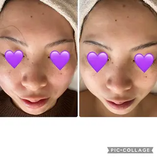 De I'm トータルビューティーサロン所属・COCO beautyサロンのエステ・リラクイメージ