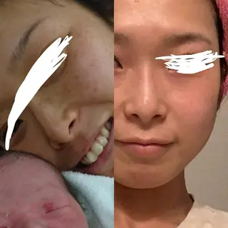 Meetite 小林のエステ・リラクイメージ