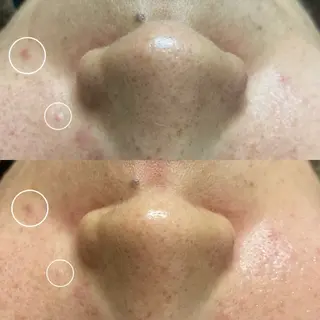 磐田｜LAYLA 一番丁寧な脱毛店のエステ・リラクイメージ