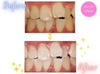 セルフホワイトニング エクシア西宮北口店所属・セルフホワイトニング エクシア西宮北口店のその他イメージ