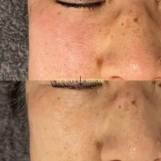 ビューティー ミロワールのエステ・リラクイメージ