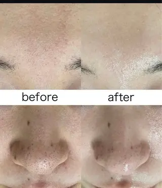 韓国美肌/肌質改善 【天神】yuiのエステ・リラクイメージ