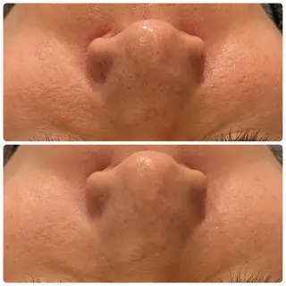 yellow.所属・yellow💛【 脱毛&フェイシャル】のエステ・リラクイメージ