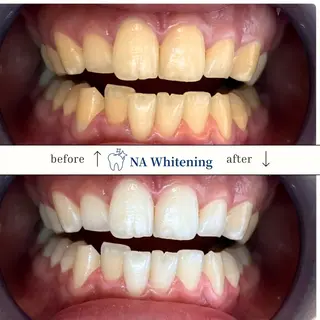 NAホワイトニング溝の口店所属・NAホワイトニング 溝の口店のエステ・リラクイメージ