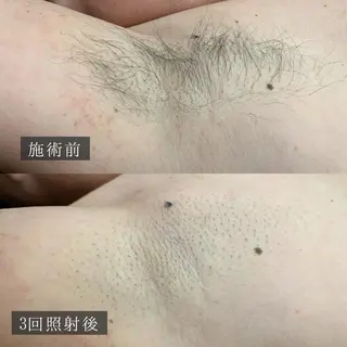 メンズ 脱毛専門サロン BELFINE恵比寿のエステ・リラクイメージ