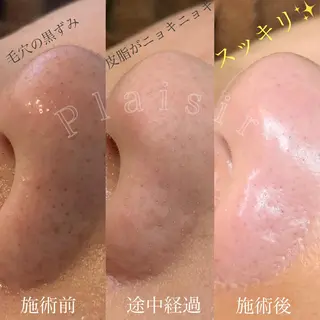 eyelashsalon Plaisir所属・ツカハラ ミカのエステ・リラクイメージ