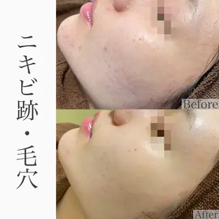 ハーブピーリング専門 BIOEL横浜のエステ・リラクイメージ