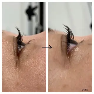 マツエク・マツパ ビューティー ミロワールのエステ・リラクイメージ