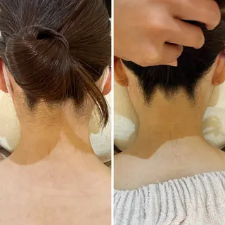 うなじ脱毛/美肌脱毛 LABELのエステ・リラクイメージ