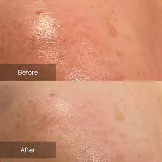 Mandarin Orange所属・毛穴から始める肌メン テマンダリンオレンジのエステ・リラクイメージ