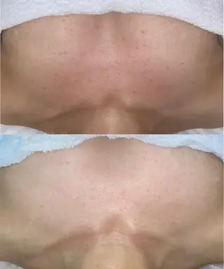 肌質改善 KALANCHOEのエステ・リラクイメージ