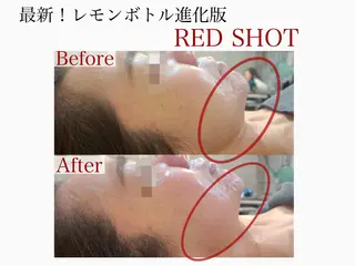 🌸🧡六本木 脱毛しずか🧡🫧の眉毛・アイブロウイメージ