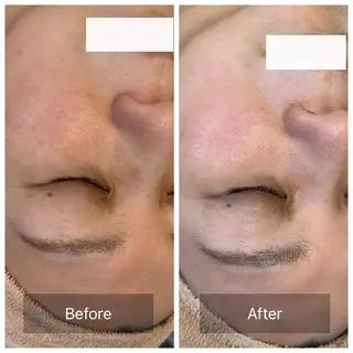 facial aesthetic salon SENTEUR所属・美肌改善/毛穴/シミ サントゥールのエステ・リラクイメージ