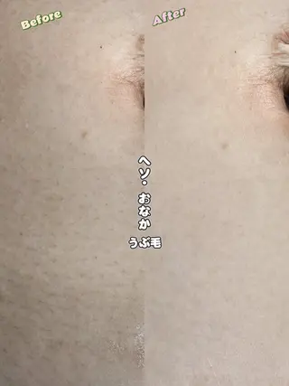 Hit. シュガーリング豊橋のエステ・リラクイメージ