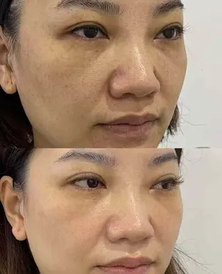 ネイル aliaハイフ&水光ジェットサロン所属・aliaハーブ水光店 エステティシャン募集のエステ・リラクイメージ