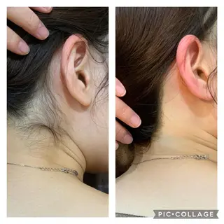 【天神・大名】脱毛/ ハーブ植松७९०のその他イメージ