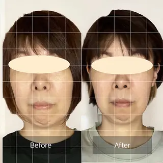 ルコナビューティ所属・小顔・歪み専門 井元 朋子のエステ・リラクイメージ