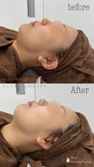 肌質改善|美眉サロンCannone'所属・肌質改善|美眉サロン Cannone’のエステ・リラクイメージ