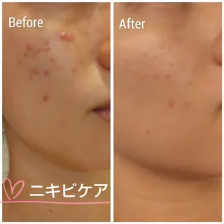 畑 彩愛のエステ・リラクイメージ