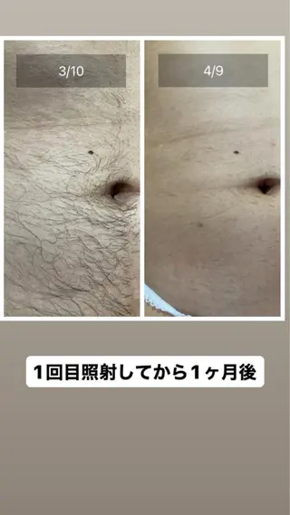 メンズ salon rosariumのエステ・リラクイメージ