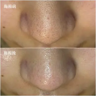 毛穴専門店アイミュー mamiのエステ・リラクイメージ