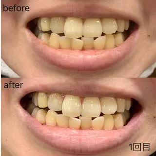 smile nail スマイルネイルのその他イメージ