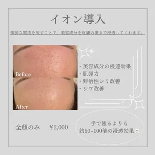 メンズ キッズ Amaryllis 💜河田のエステ・リラクイメージ