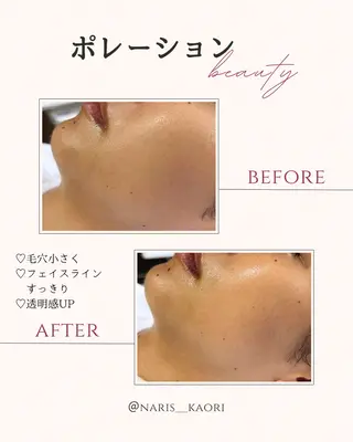 フェイシャルエステ♡ KAORIのエステ・リラクイメージ