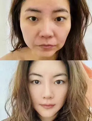 マツエク・マツパ aliaハイフ&水光ジェットサロン所属・aliaハーブ水光店 エステティシャン募集のエステ・リラクイメージ