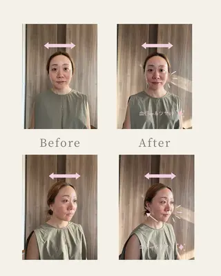 mimine エメラルド式耳つぼのその他イメージ