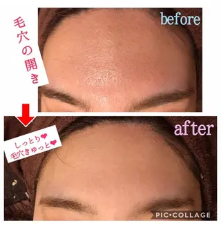 ミディアム カラー パーマ ヘアアレンジ メンズ キッズ ネイル マツエク・マツパ 四つ星サロン🎖 腸＆ニキビケアに特化のエステ・リラクイメージ