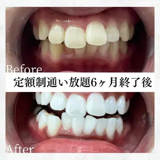 メンズ セルフホワイトニング WHITE福岡博多店のエステ・リラクイメージ