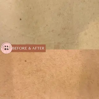 男女兼用脱毛＆ドライ ヘッドスパ トレテルのエステ・リラクイメージ