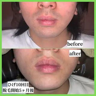 メンズ 天神【効果重視脱毛】 YouMakeのエステ・リラクイメージ