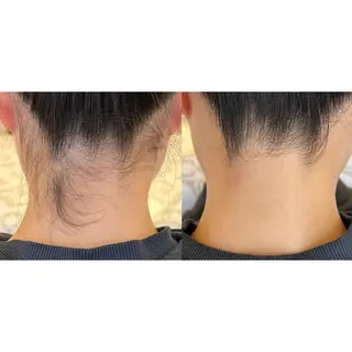 ワックス脱毛🌈 ESPOIRnocoのエステ・リラクイメージ