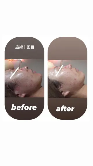 【足圧】鬼👹リンパ 身体整うサロンのエステ・リラクイメージ