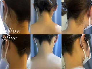 うなじ脱毛/美肌脱毛 LABELのエステ・リラクイメージ