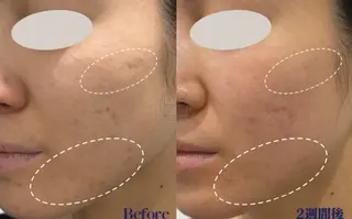 マツエク・マツパ 愛維美水光美肌専門店所属・愛維美水光美肌専門店 メンズレディースokのエステ・リラクイメージ