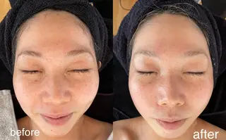 Lavi&所属・肌質改善サロン Lavi&のその他イメージ