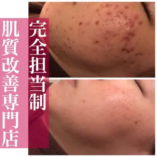 ミディアム カラー パーマ ヘアアレンジ メンズ キッズ ネイル マツエク・マツパ アイブロウ ニキビ・肌質改善専門 ♡人生が変わるサロンのエステ・リラクイメージ