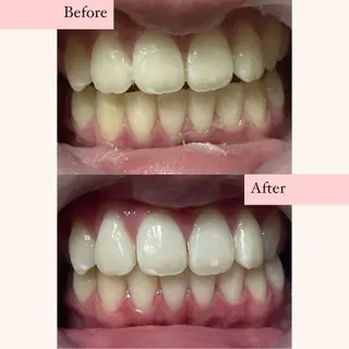 ホワイトニングサロン nybeのその他イメージ