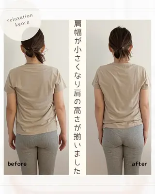 小顔矯正& 慢性肩こり腰痛改善店のエステ・リラクイメージ