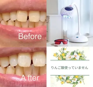 整体フェイシャル EMINALのエステ・リラクイメージ