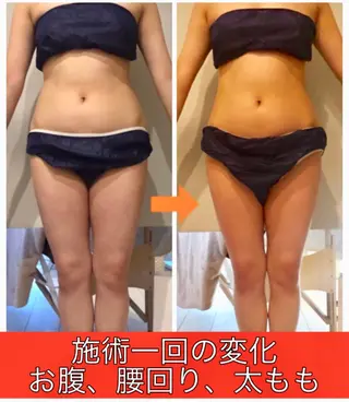 ロング カラー パーマ ヘアアレンジ メンズ キッズ ネイル マツエク・マツパ ‍痩身＆ボディ 結果出し🌟丹野のエステ・リラクイメージ