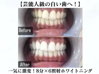 LOVE ホワイトニング新宿店のエステ・リラクイメージ